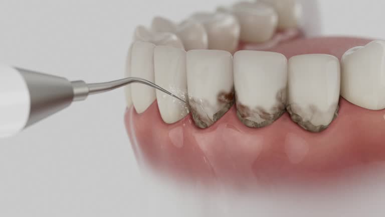 Reliable Root Canal Treatment contractor in Jessamine County County, KY by Dentist Open Now